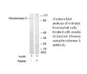 Product image for Hexokinase-3 Antibody