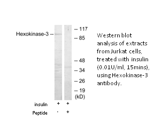 Product image for Hexokinase-3 Antibody