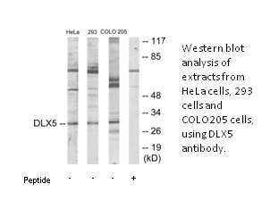 Product image for DLX5 Antibody