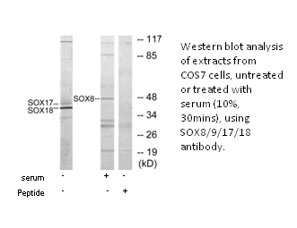 Product image for SOX8/9/17/18 Antibody