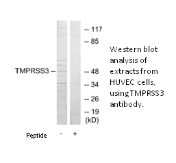 Product image for TMPRSS3 Antibody