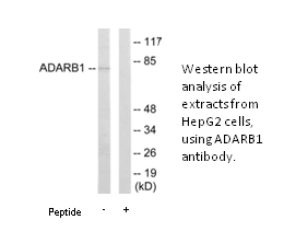 Product image for ADARB1 Antibody