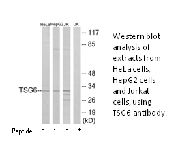 Product image for TSG6 Antibody