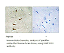 Product image for MAP3K10 Antibody