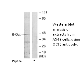 Product image for OCT6 Antibody