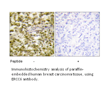Product image for ERCC6 Antibody