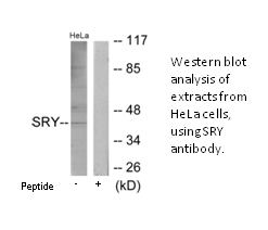 Product image for SRY Antibody