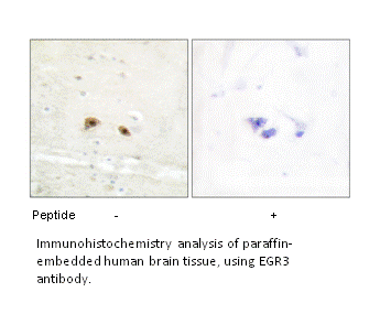 Product image for EGR3 Antibody