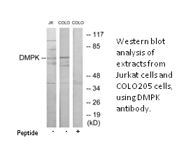 Product image for DMPK Antibody