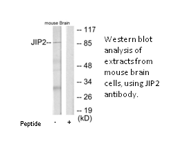 Product image for JIP2 Antibody
