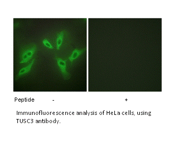 Product image for TUSC3 Antibody