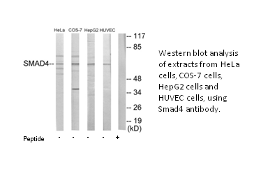 Product image for Smad4 Antibody
