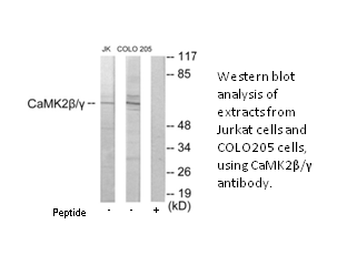 Product image for CaMK2&beta;/&gamma; Antibody