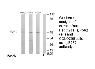 Product image for E2F2 Antibody