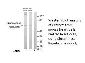Product image for Glucokinase Regulator Antibody