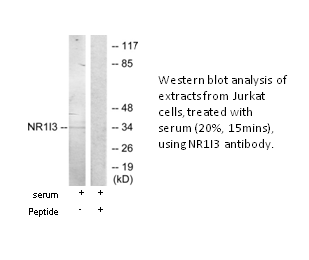 Product image for NR1I3 Antibody