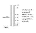 Product image for ANKRD1 Antibody