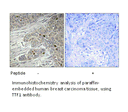 Product image for TTF1 Antibody