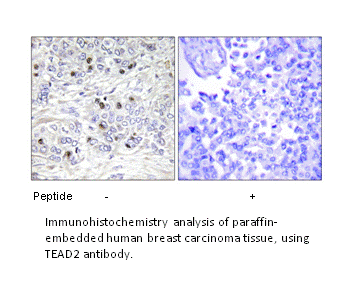 Product image for TEAD2 Antibody