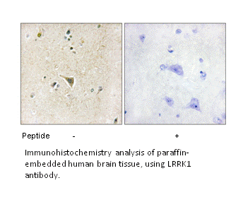 Product image for LRRK1 Antibody