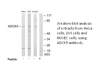Product image for ADCK5 Antibody