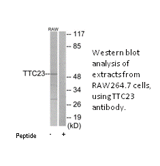 Product image for TTC23 Antibody
