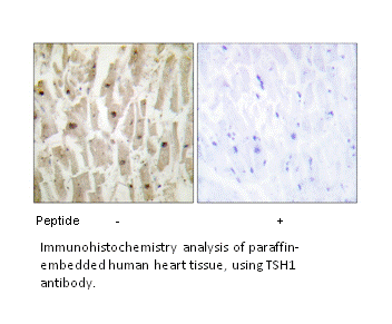 Product image for TSH1 Antibody