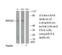 Product image for ADCK2 Antibody