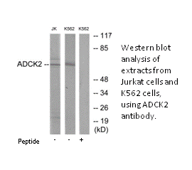 Product image for ADCK2 Antibody