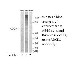 Product image for ADCK1 Antibody