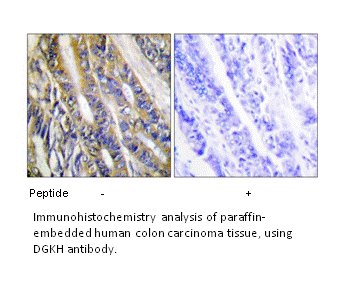 Product image for DGKH Antibody
