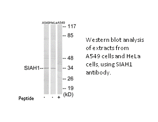 Product image for SIAH1 Antibody