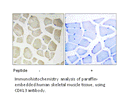 Product image for CDKL3 Antibody