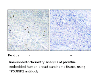 Product image for TP53INP2 Antibody