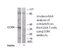 Product image for CCRK Antibody