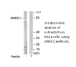 Product image for ANKK1 Antibody