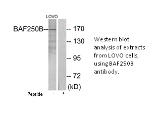 Product image for BAF250B Antibody