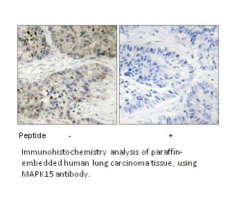 Product image for MAPK15 Antibody
