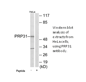 Product image for PRP31 Antibody