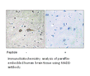 Product image for MADD Antibody