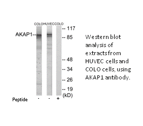 Product image for AKAP1 Antibody