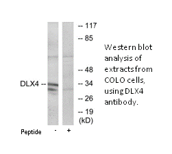 Product image for DLX4 Antibody