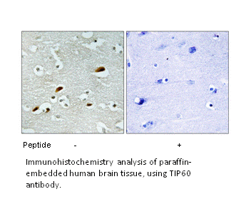 Product image for TIP60 Antibody