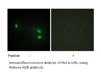 Product image for Histone H2B Antibody
