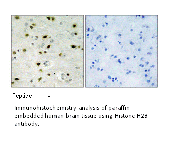 Product image for Histone H2B Antibody