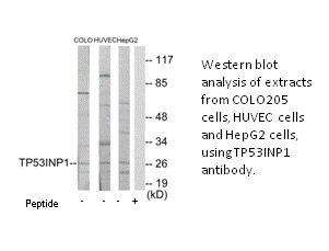Product image for TP53INP1 Antibody