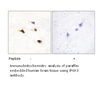 Product image for IP6K3 Antibody