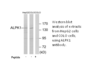 Product image for ALPK1 Antibody