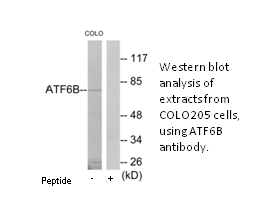 Product image for ATF6B Antibody