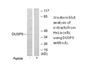 Product image for DUSP9 Antibody